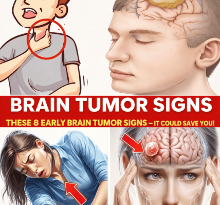 Don’t Miss These 8 Early Signs of a Brain Tumor – Early Detection Can Make a Difference – Health