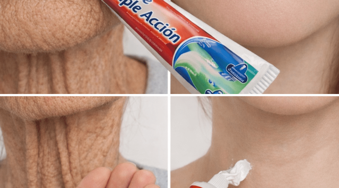 The Simple Homemade Remedy Many People Use to Improve Wrinkles and Dark Spots on Hands and Arms – Health