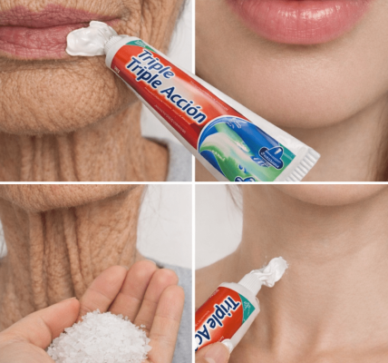 The Simple Homemade Remedy Many People Use to Improve Wrinkles and Dark Spots on Hands and Arms – Health