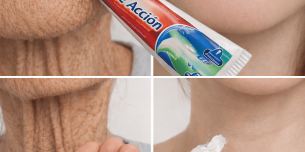 The Simple Homemade Remedy Many People Use to Improve Wrinkles and Dark Spots on Hands and Arms – Health