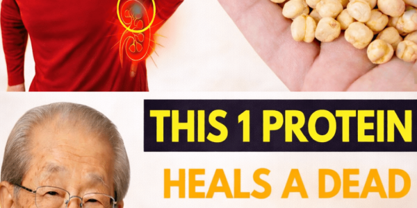 6 Proteins to Avoid If You Have Kidney Issues (and 4 Safer Alternatives) – Health