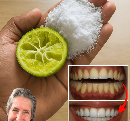 Kitchen Secrets for a Hollywood Smile ✨ – dogpjs.com – Health