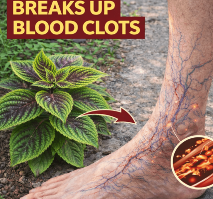 Are Everyday Herbs the Secret to Supporting Better Leg Circulation and Easing Heavy, Tired Feelings?