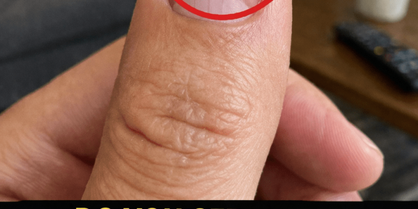 What Do Those Lines on Your Nails Really Mean? A Closer Look at Nail Ridges and Your Health What Do Those Lines on Your Nails Really Mean? A Closer Look at Nail Ridges and Your Health