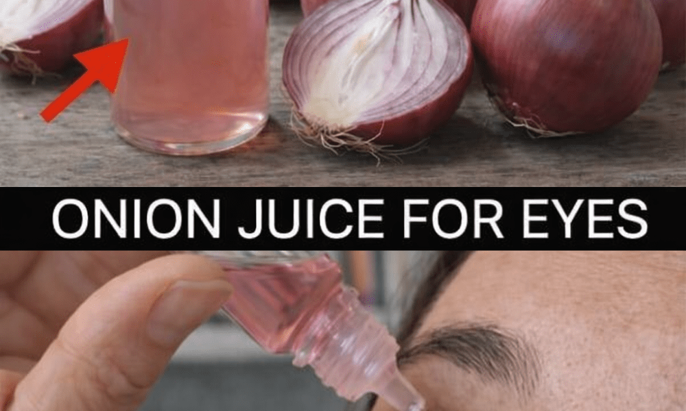 How Can Onions Help Support Your Eye Health Naturally at Home? – Health