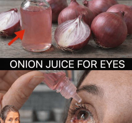 How Can Onions Help Support Your Eye Health Naturally at Home? – Health