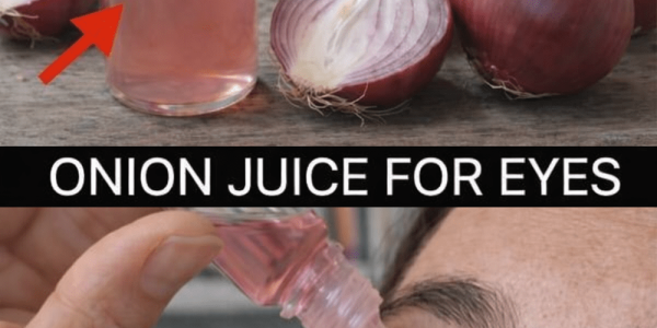 How Can Onions Help Support Your Eye Health Naturally at Home? – Health