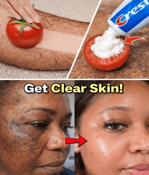 Discover the Viral Toothpaste and Tomato Face Mask Many Are Trying for the Look of Smaller Pores, Faded Dark Spots, Brighter Skin and Gentler Facial Hair Reduction