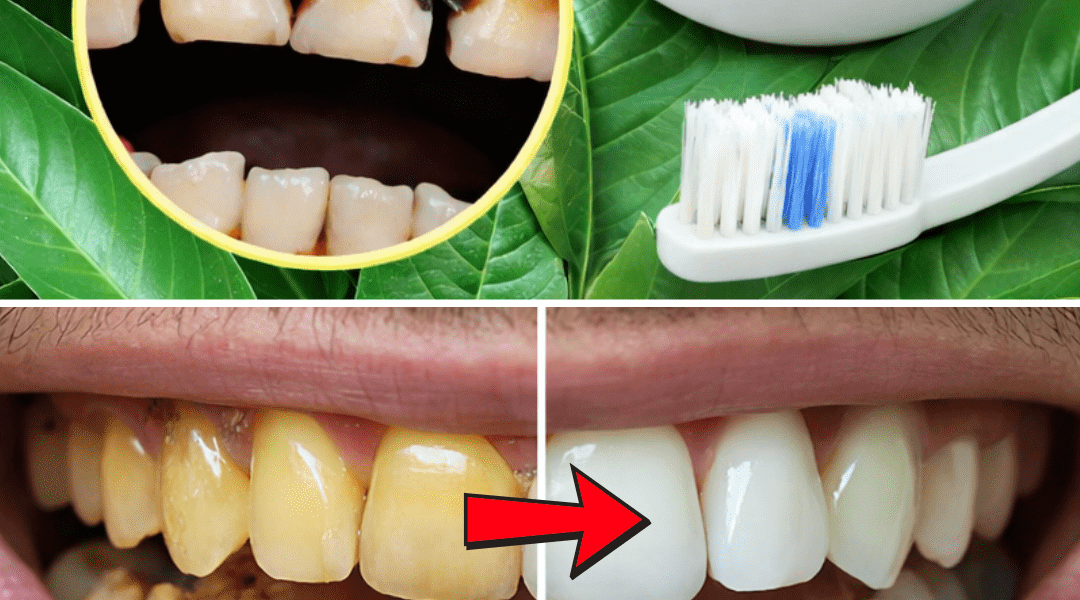 Top 3 Ways to Treat Tooth Decay with Guava Leaves – Simple and Cost-Effective – Health