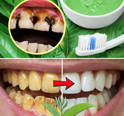Top 3 Ways to Treat Tooth Decay with Guava Leaves – Simple and Cost-Effective – Health