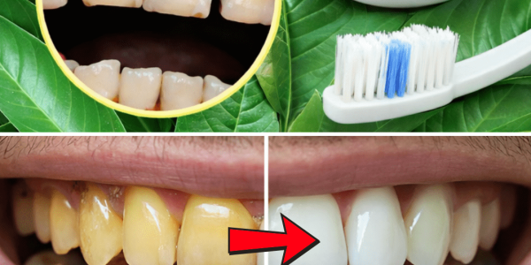 Top 3 Ways to Treat Tooth Decay with Guava Leaves – Simple and Cost-Effective – Health