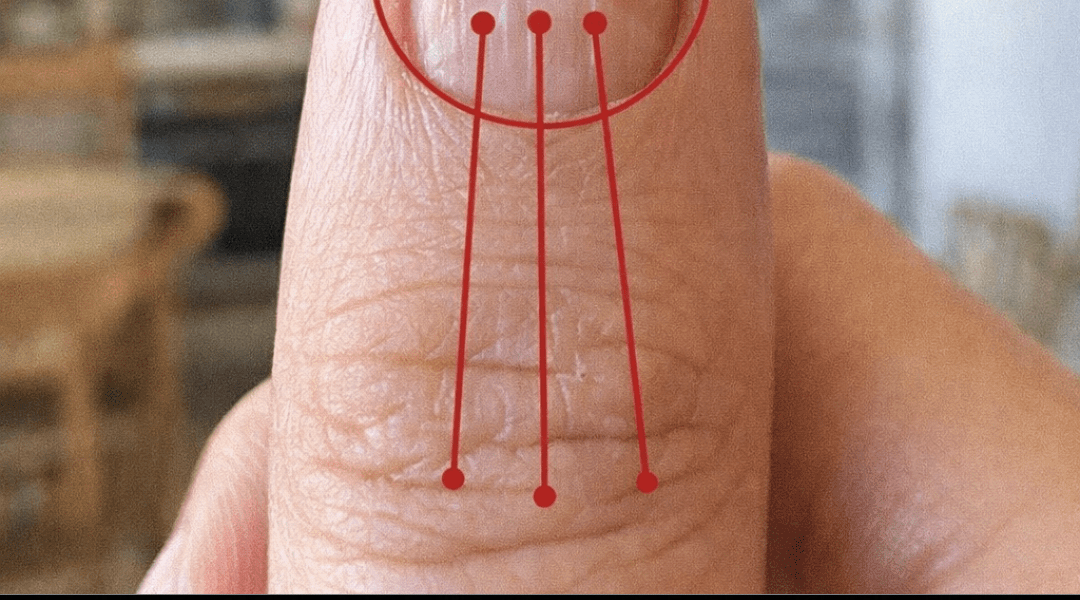 Lines on Your Fingernails: What They Might Reveal About Your Health Lines on Your Fingernails: What They Might Reveal About Your Health
