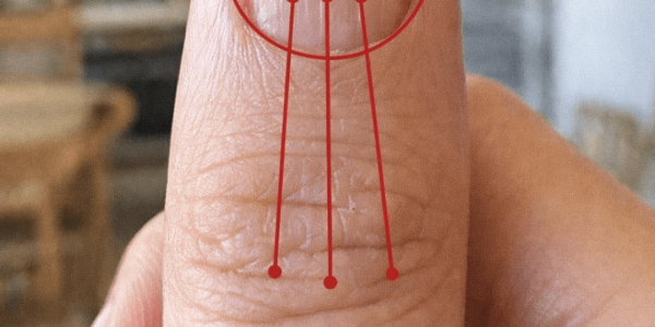 Lines on Your Fingernails: What They Might Reveal About Your Health