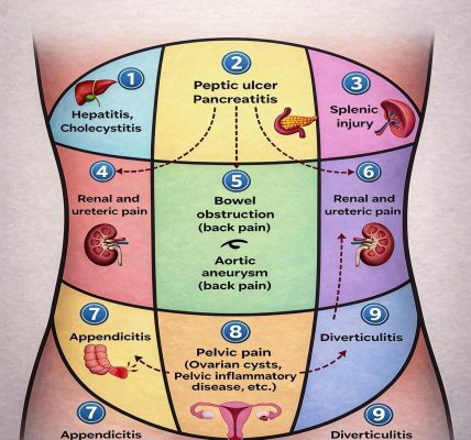 Abdominal Pain Referral Areas Explained: Your Complete Guide to Understanding Pain in Different Parts of the Abdomen
