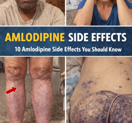 10 Common Amlodipine Side Effects You Should Know About If You Take This Popular Blood Pressure Medication