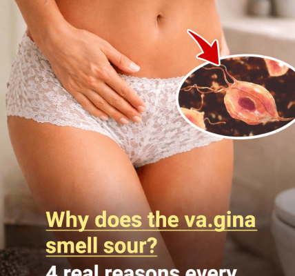 Why Does Your Vaginal Discharge Smell Sour? What Every Woman Should Know About Vaginal Wellness