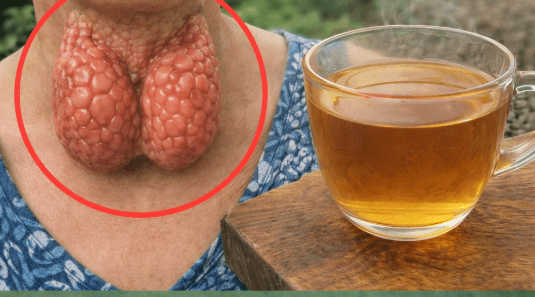 How to Support Your Thyroid Health Naturally With 6 Simple Steps You Can Start Today