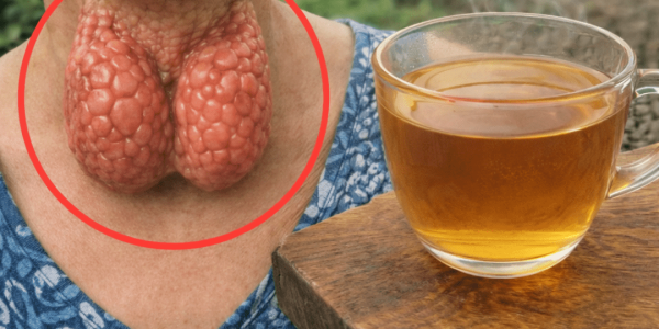 How to Support Your Thyroid Health Naturally With 6 Simple Steps You Can Start Today
