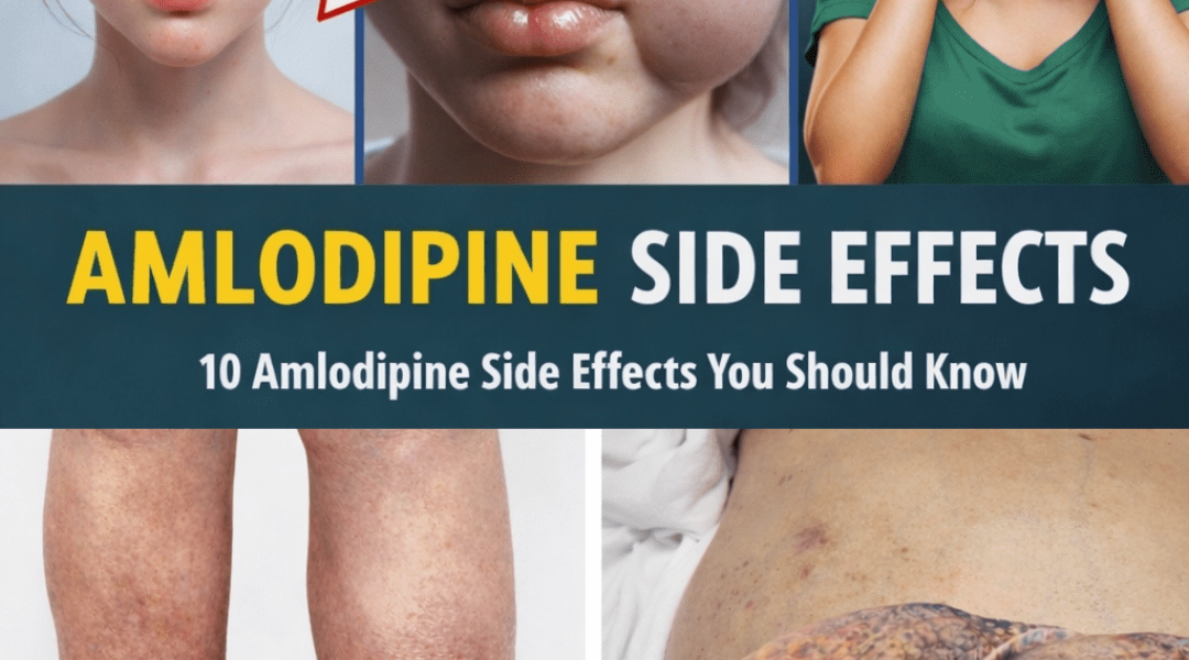 The 12 Most Common Amlodipine Side Effects and Why They Happen to So Many People