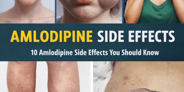 The 12 Most Common Amlodipine Side Effects and Why They Happen to So Many People