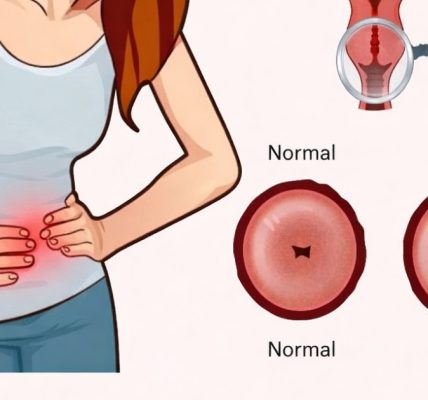 Cervical Cancer Symptoms You Should Never Ignore