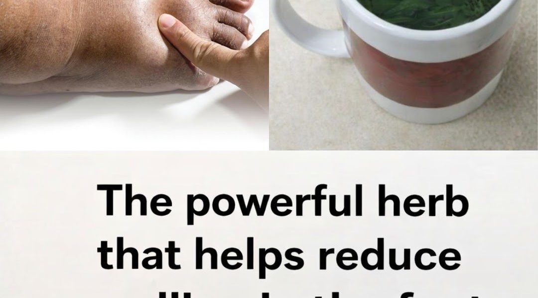 8 Best Diuretic Teas to Reduce Bloating and Fluid Retention Naturally 8 Best Diuretic Teas to Reduce Bloating and Fluid Retention Naturally