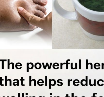 8 Best Diuretic Teas to Reduce Bloating and Fluid Retention Naturally