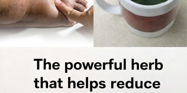 8 Best Diuretic Teas to Reduce Bloating and Fluid Retention Naturally
