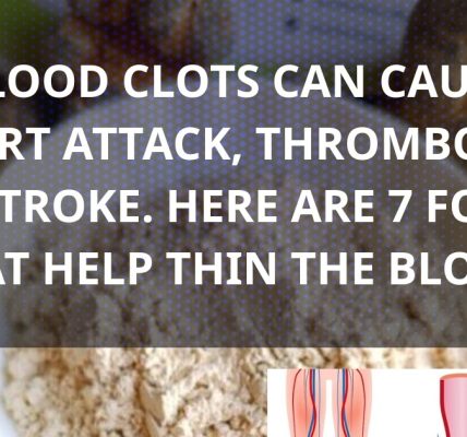 7 Natural Foods That Help Thin the Blood and Protect Your Heart 7 Natural Foods That Help Thin the Blood and Protect Your Heart