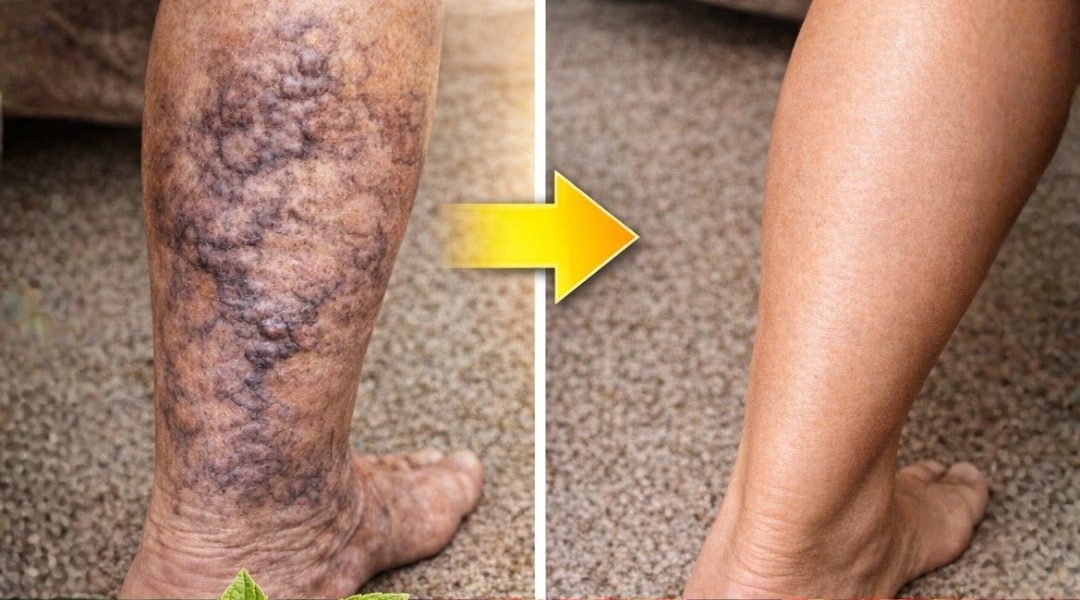 Why Blood Circulation in Your Legs Is More Important Than You Think Why Blood Circulation in Your Legs Is More Important Than You Think