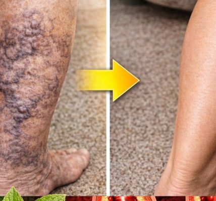 Why Blood Circulation in Your Legs Is More Important Than You Think