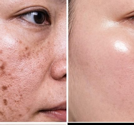 Say Goodbye to Dark Spots and Get Clear Skin Say Goodbye to Dark Spots and Get Clear Skin