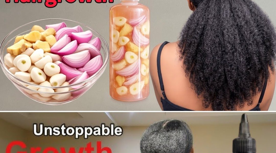 The Indian Secret to Rocket-Speed Hair Growth and Natural Baldness Treatment The Indian Secret to Rocket-Speed Hair Growth and Natural Baldness Treatment