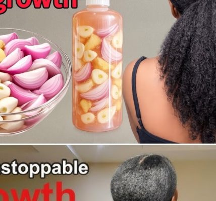 The Indian Secret to Rocket-Speed Hair Growth and Natural Baldness Treatment The Indian Secret to Rocket-Speed Hair Growth and Natural Baldness Treatment