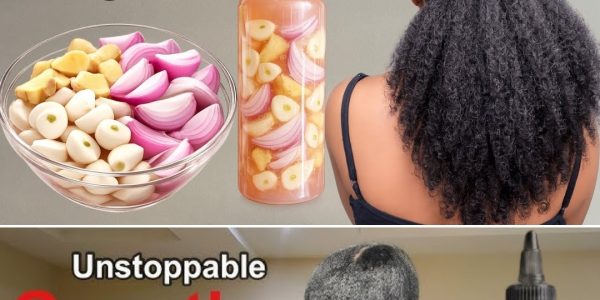 The Indian Secret to Rocket-Speed Hair Growth and Natural Baldness Treatment The Indian Secret to Rocket-Speed Hair Growth and Natural Baldness Treatment