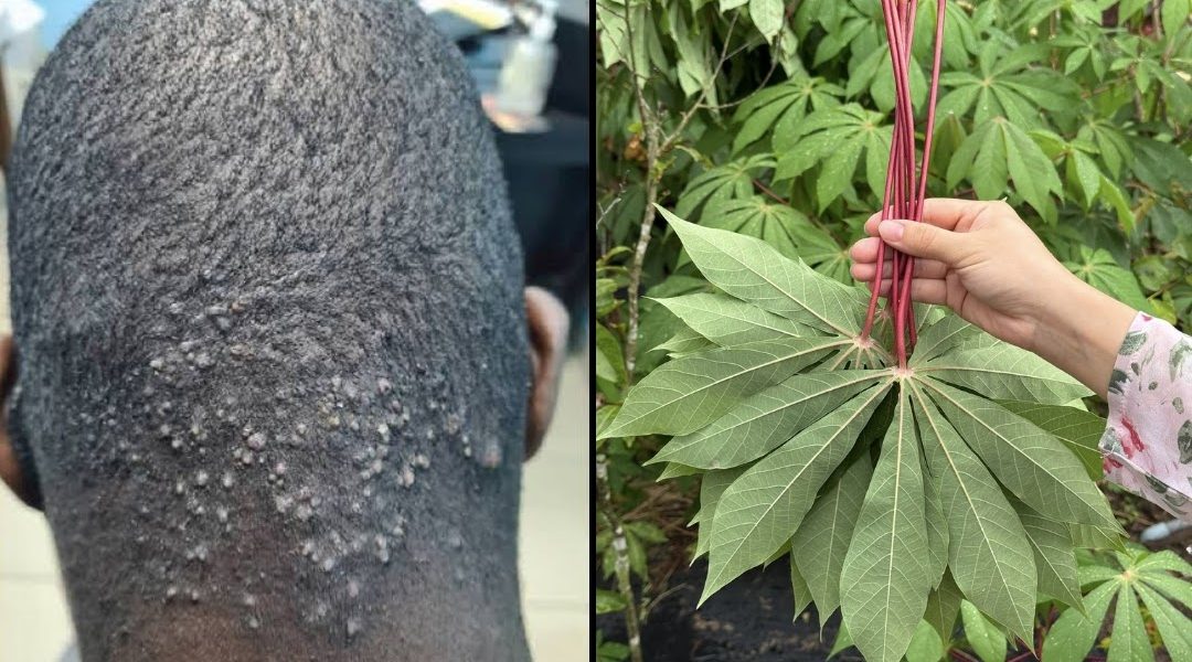 Bitter Leaves & Cassava Leaves Treatment Bitter Leaves & Cassava Leaves Treatment