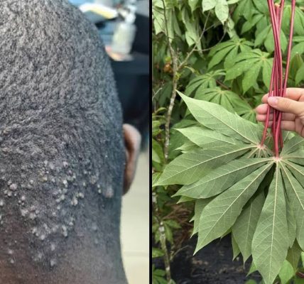 Bitter Leaves & Cassava Leaves Treatment