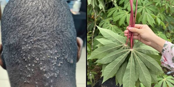 Bitter Leaves & Cassava Leaves Treatment Bitter Leaves & Cassava Leaves Treatment