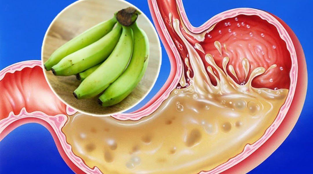 A Powerful Natural Remedy for Stomach Problems