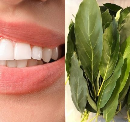 Natural Relief for Swollen and Bleeding Gums Natural Relief for Swollen and Bleeding Gums