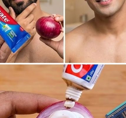 Stop Shaving! Try This Pain-Free Method to Remove Facial and Body Hair Naturally 🧐