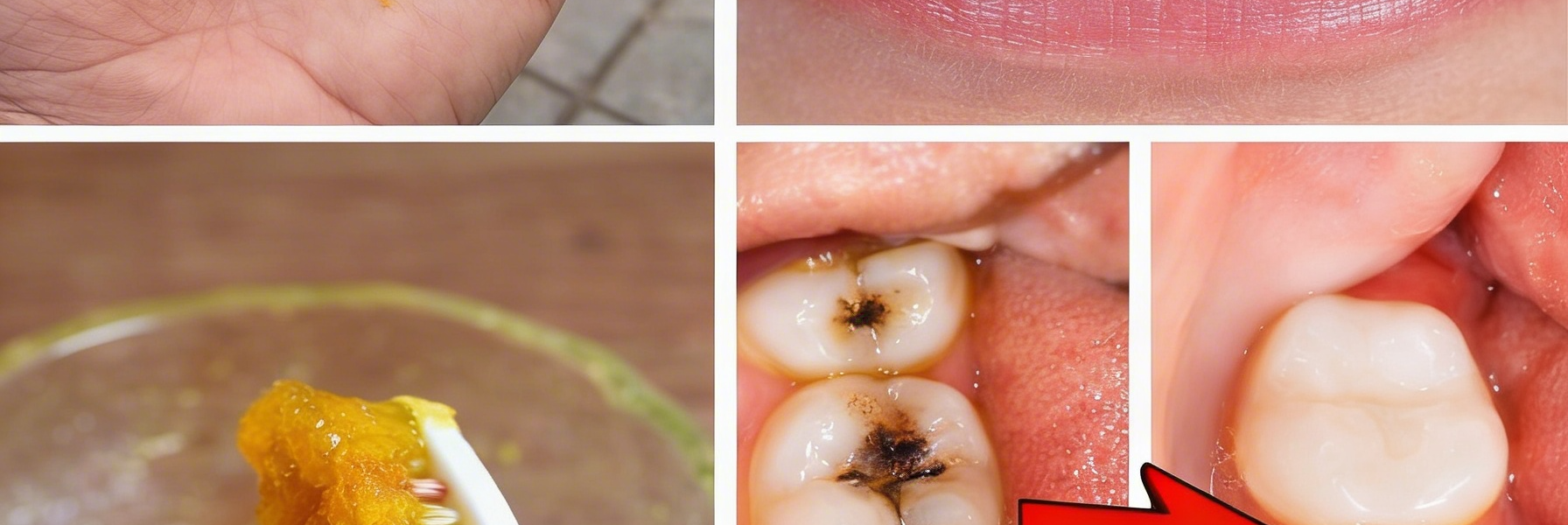 Turmeric for Teeth Whitening: Does This Natural Spice Actually Brighten Your Smile? Turmeric for Teeth Whitening: Does This Natural Spice Actually Brighten Your Smile?