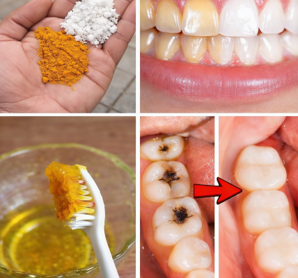 Turmeric for Teeth Whitening: Does This Natural Spice Actually Brighten Your Smile?