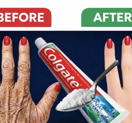 “People Think I Had Cosmetic Surgery!” – A Gentle Natural Routine to Help Soften Wrinkles and Dark Spots on Hands and Arms “People Think I Had Cosmetic Surgery!” – A Gentle Natural Routine to Help Soften Wrinkles and Dark Spots on Hands and Arms