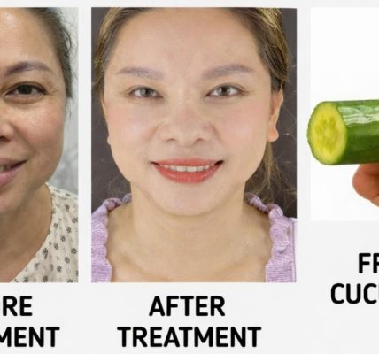 How This Simple Ingredient Helps Fade Wrinkles and Dark Spots Naturally How This Simple Ingredient Helps Fade Wrinkles and Dark Spots Naturally