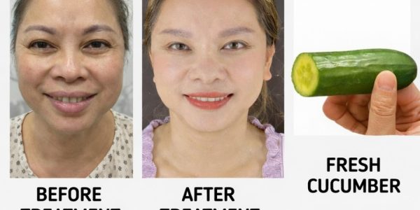 How This Simple Ingredient Helps Fade Wrinkles and Dark Spots Naturally How This Simple Ingredient Helps Fade Wrinkles and Dark Spots Naturally