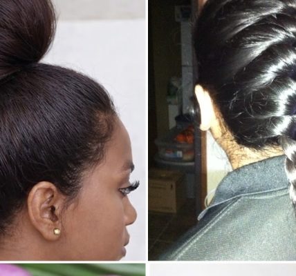 The Secret Remedy No One Tells You About