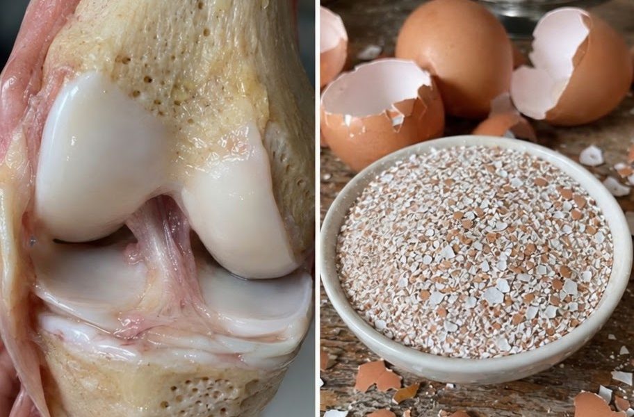 Natural Calcium Support for a Stronger Body