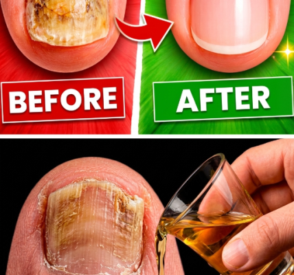 How to Identify It and Get Rid of It Effectively